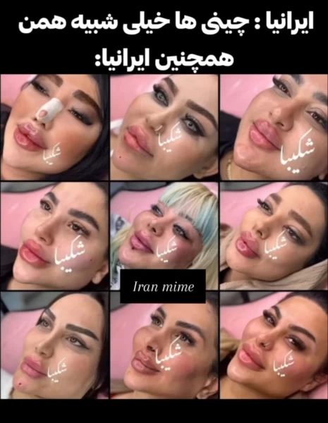 عکس