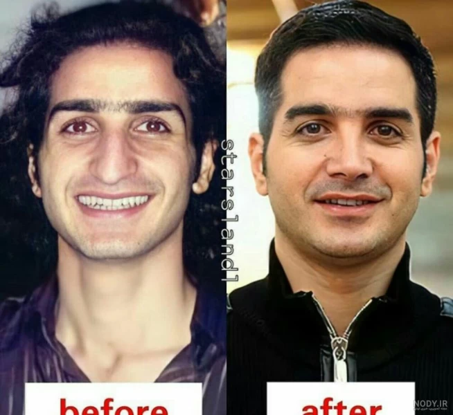 عکس