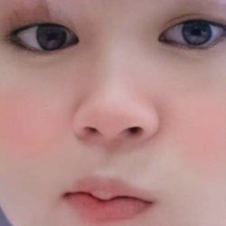 میگرن چشم!👀