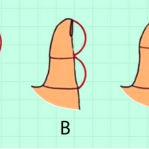 تست شخصیت شناسی از روی انگشت