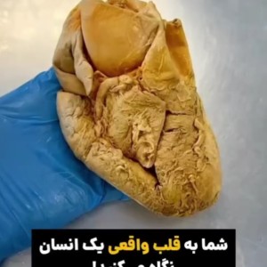 کاور