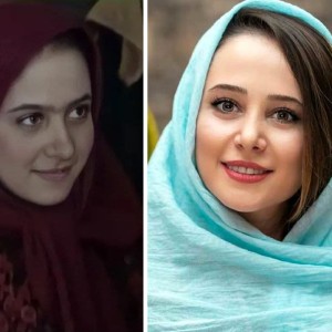 عکس بازیگران زن ایرانی قبل وبعدعمل زیبایی!