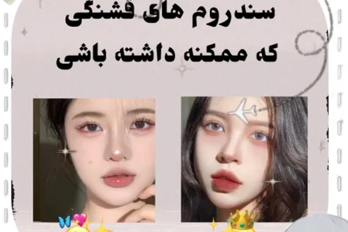 عکس سندروم های قشنگی که ممکنه داشته باشی