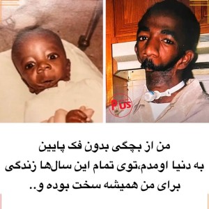 تست بدون فَک