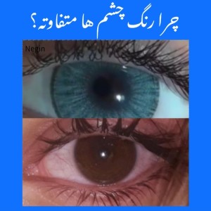 عکس چرا رنگ چشم ها فرق میکند؟