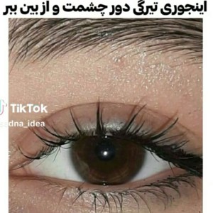 تست تیرگی زیر چشمت رو از بین ببر