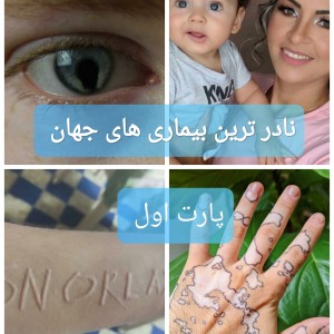 عکس نادر ترین بیماری های جهان