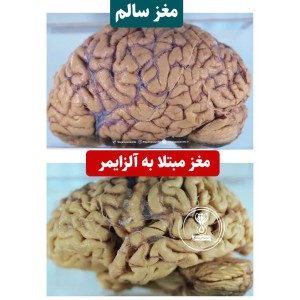 عکس حافظه هر انسان متفاوته