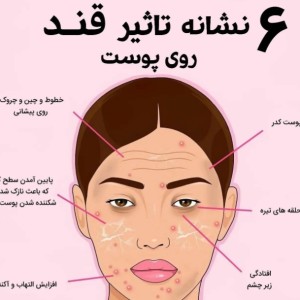 ۶ نشانه تاثیر قند روی پوست