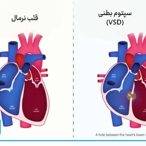 کاور