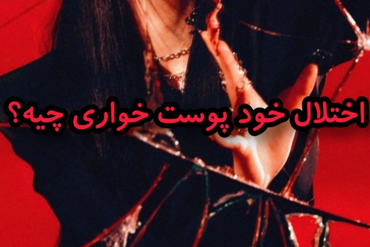 عکس اختلال خودپوست‌خواری چیه؟