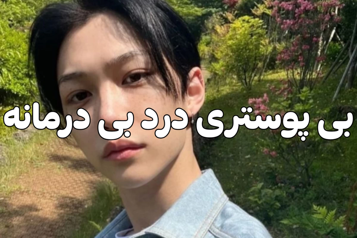 عکس آخه دلق-
