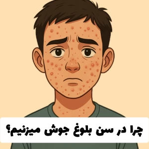 کاور
