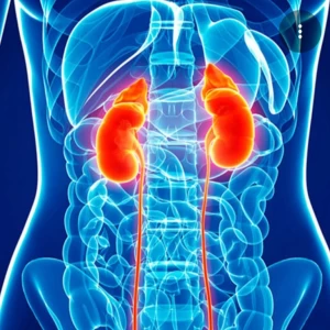 عکس سنگ کلیه یا دشمن کلیه؟