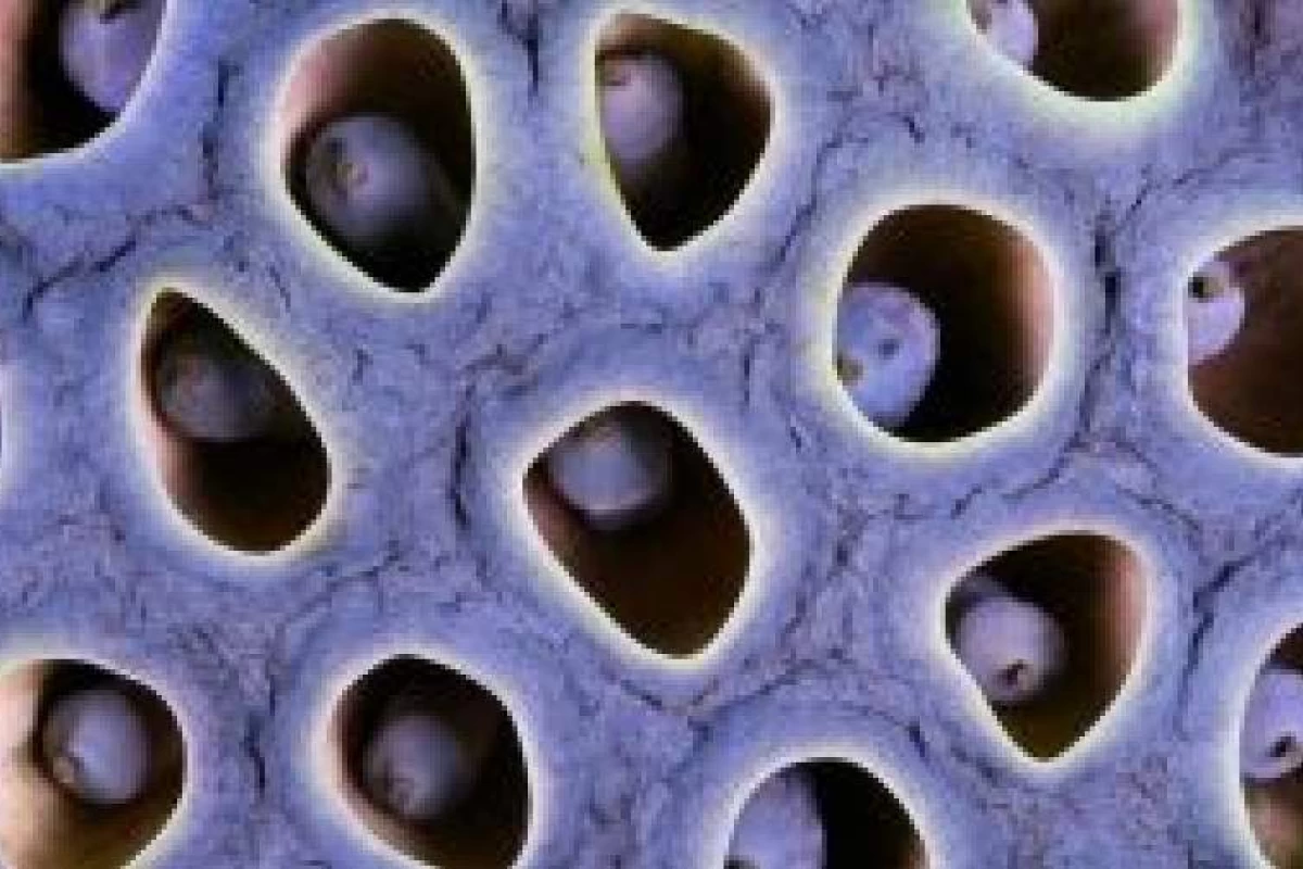 عکس بیماری ترایپوفوبیا چیست؟