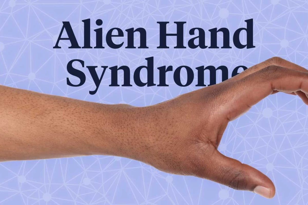 عکس Alien hand syndrome ( سندروم دست بیگانه)