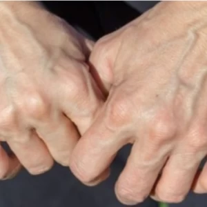 عکس چرا رگ های بدن به رنگ آبی دیده می شوند ؟