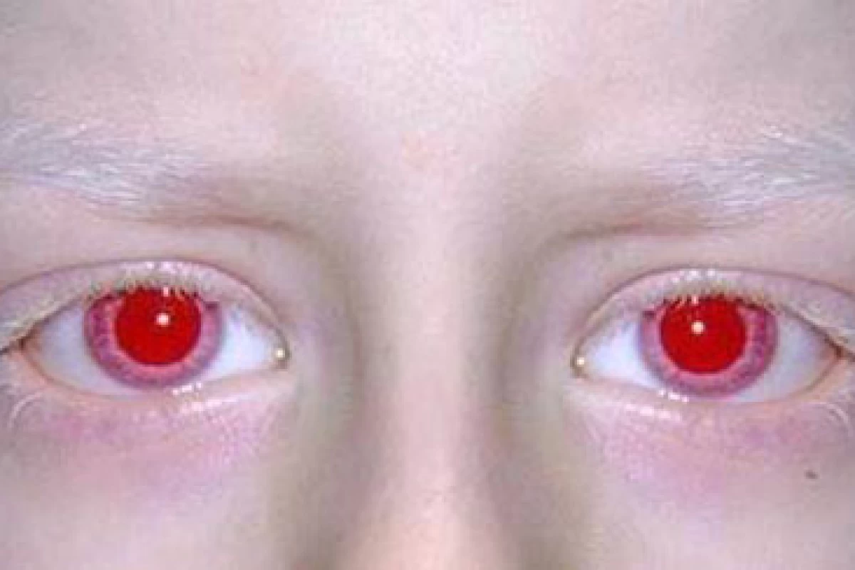 عکس من مو سفیدم... (فان)