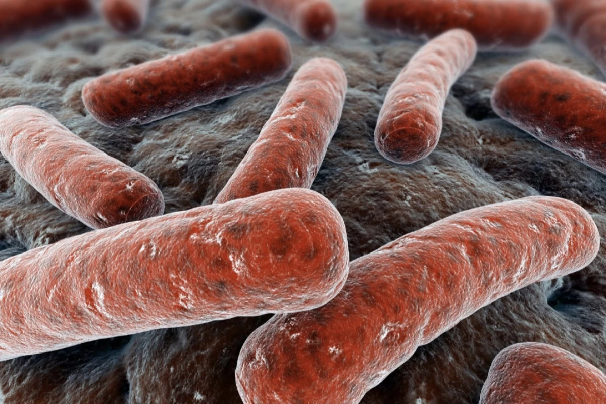 عکس یک بیماری خطرناک ( سل )