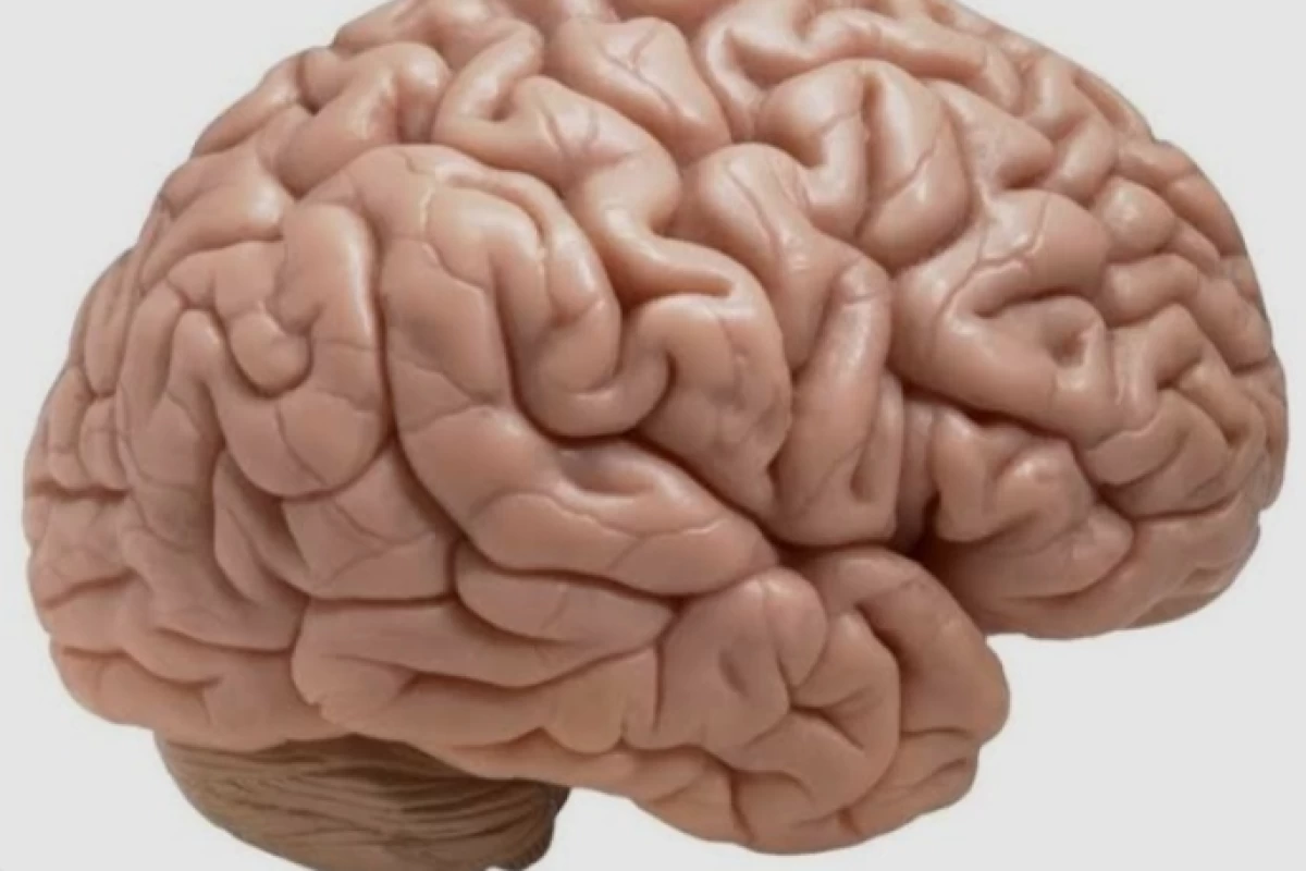 عکس مغز چیست؟؟