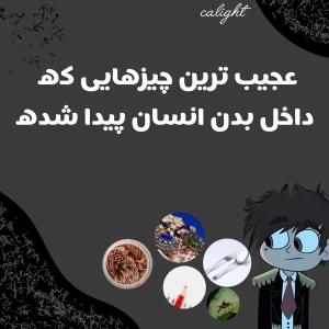 عکس عجیب ترین چیز هایی که داخل بدن انسان پیدا شده