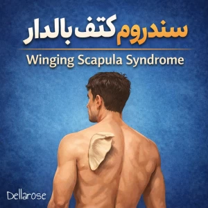 عکس سندروم کتف بالدار