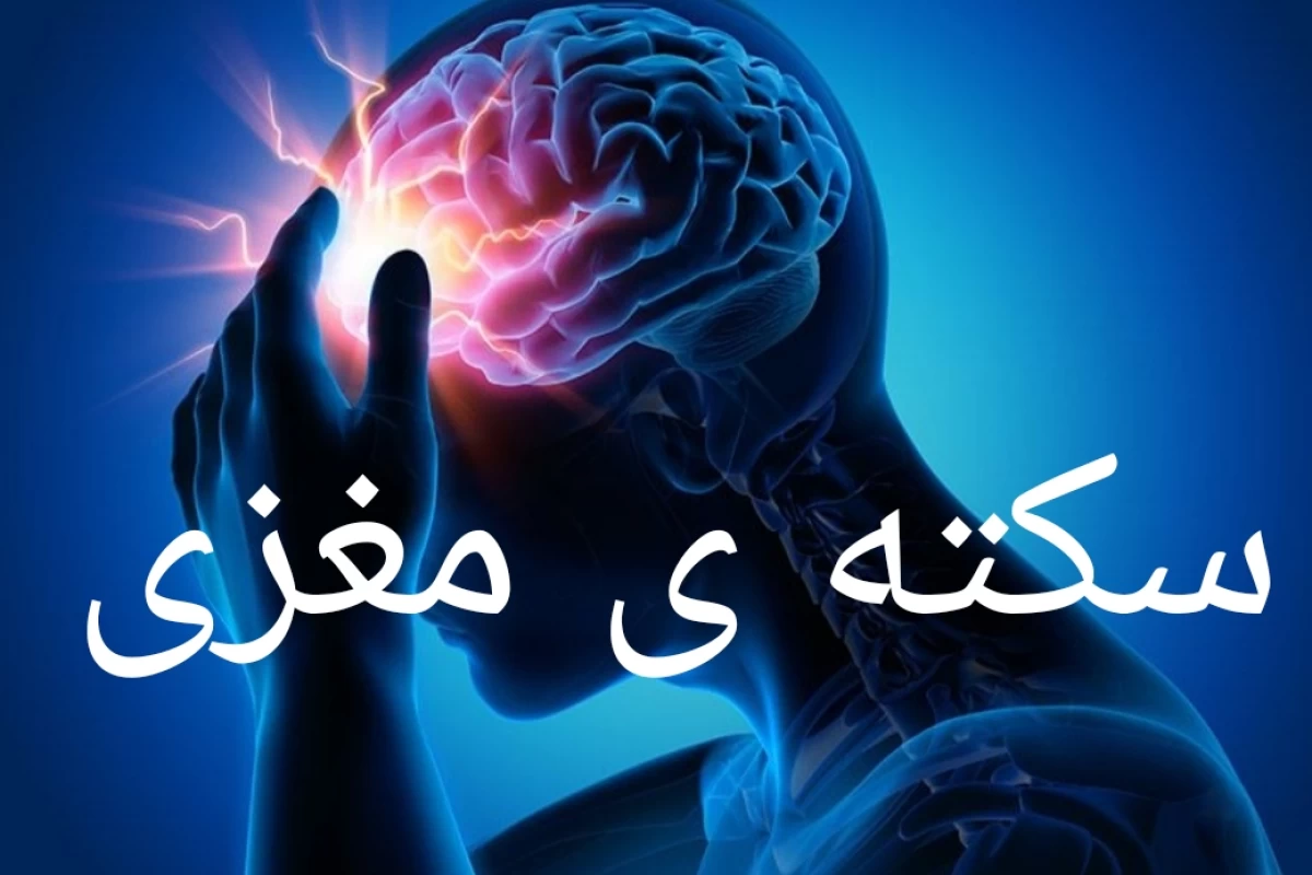 عکس سکته ی مغزی