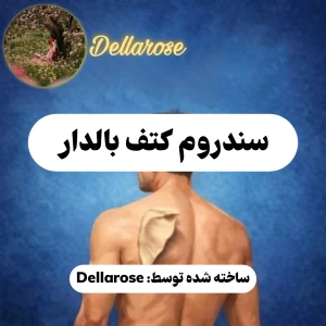 عکس سندروم کتف بالدار