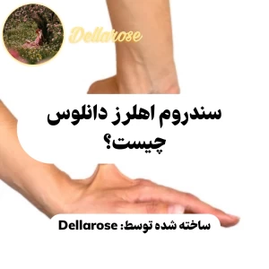 عکس سندروم اهلرز دانلوس چیست؟