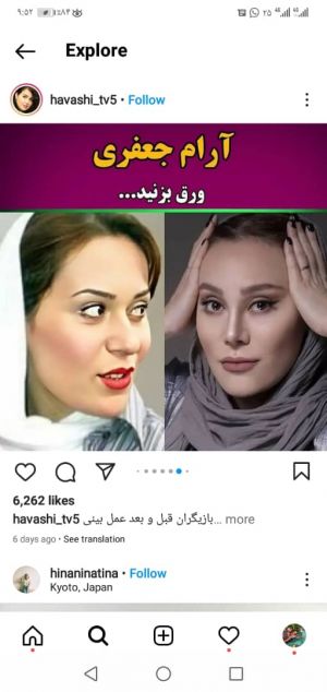 عکس