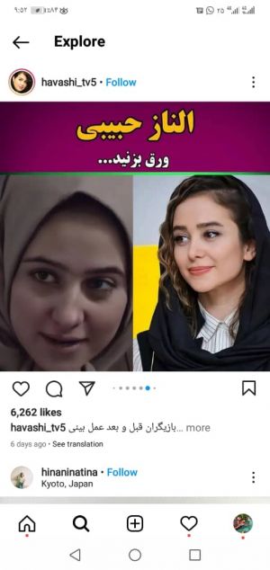 عکس