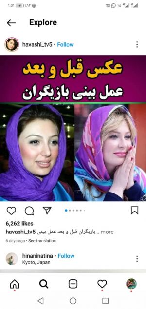 عکس