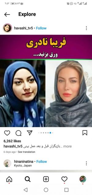 عکس
