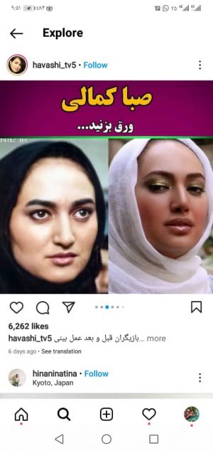 عکس
