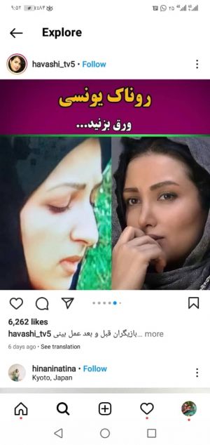 عکس