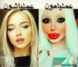 عکس