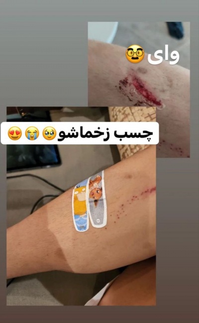 عکس