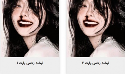 عکس