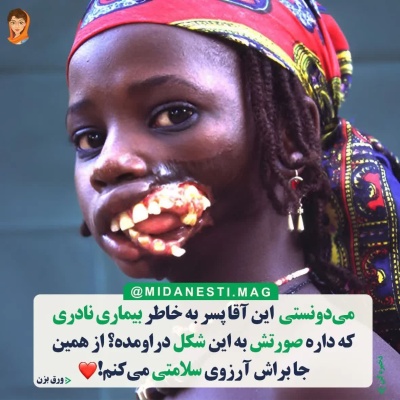 عکس