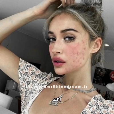 عکس