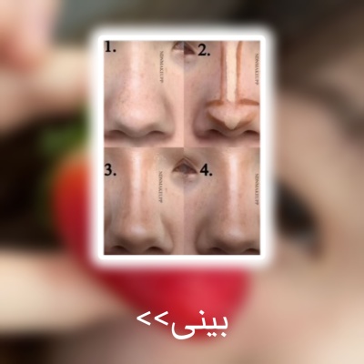 عکس