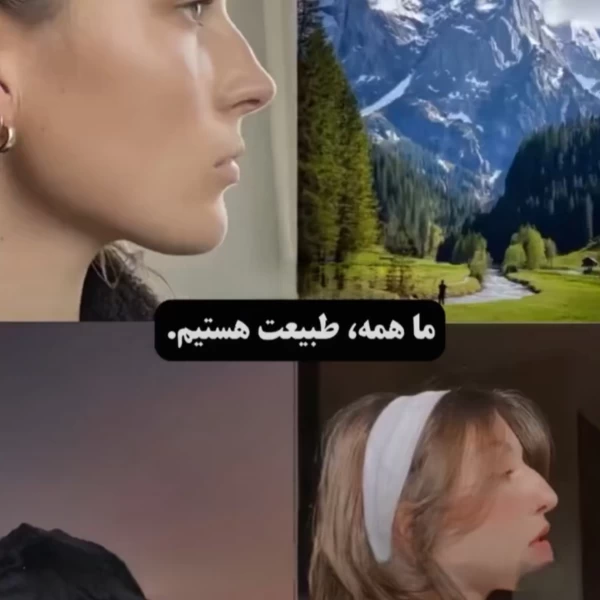 عکس