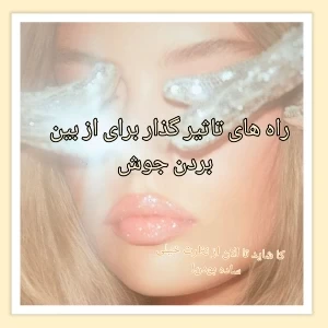 عکس داشتن پوست خوب؟