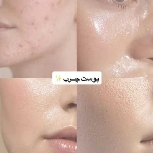 کاور