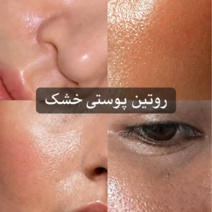 عکس}