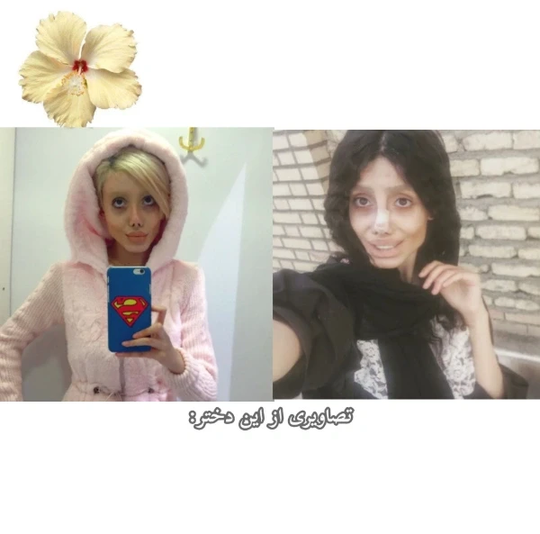 عکس